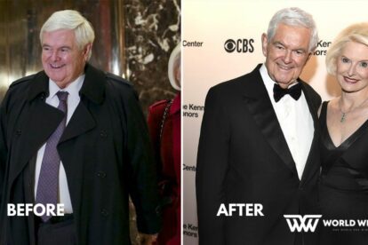 Before and after Newt Gingrich Weight Loss